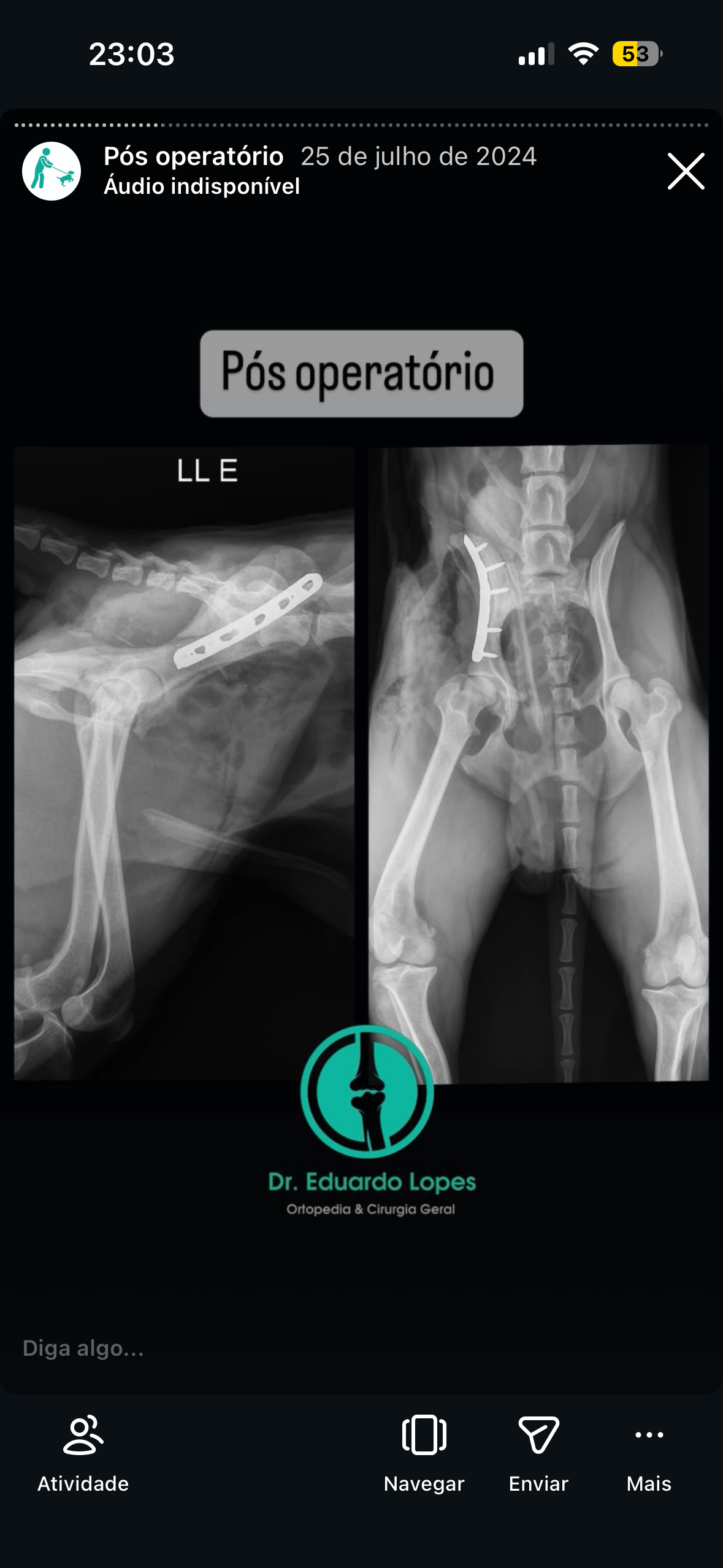 Radiografias pós-operatórias de caso ortopédico